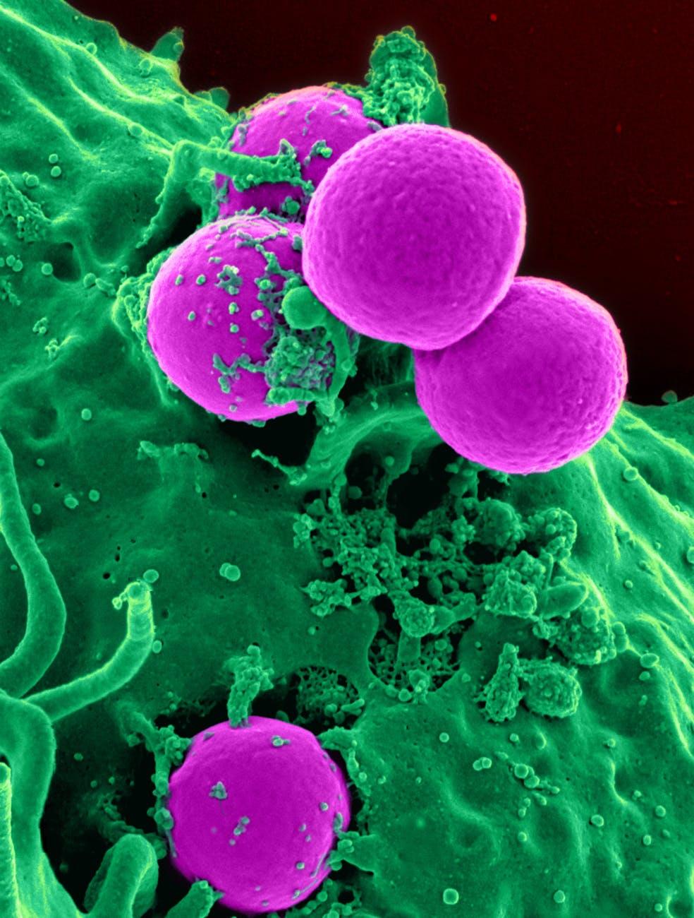 Biofilms and Chronic Infections